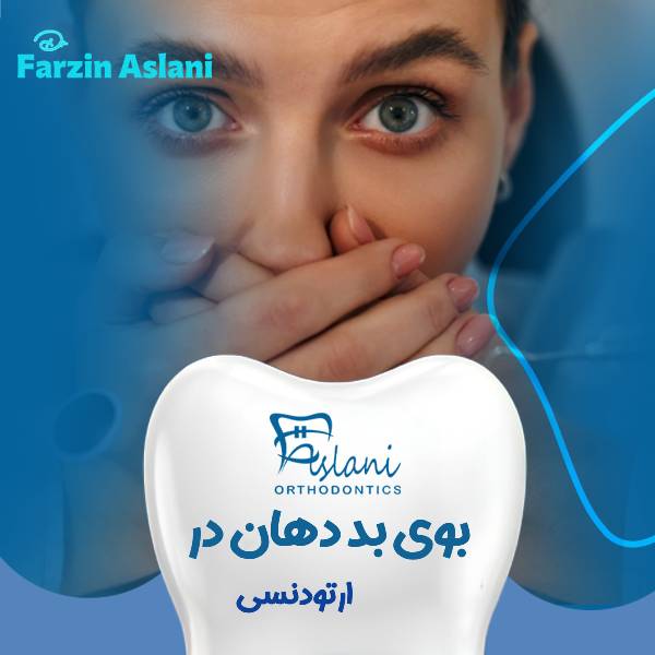 آیا ارتونسی باعث بوی بد دهان میشود؟